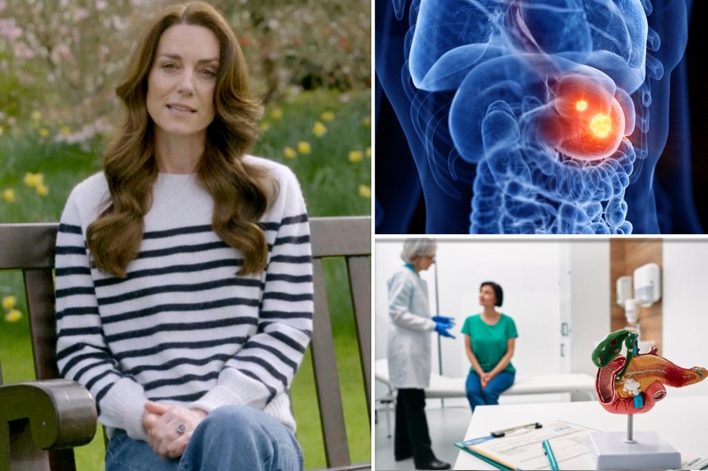 La diagnosi di Kate Middleton arriva nel mezzo di una “epidemia” di cancro in fase iniziale
